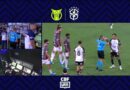 Renê detalha pressão dos jogadores do Fluminense por expulsão de Allan, do Corinthians: ‘Tivemos que fazer a cena’
