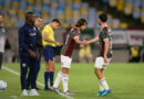 Martinelli destaca oportunidades para Xerém após amistoso: “Eles são o futuro do clube”